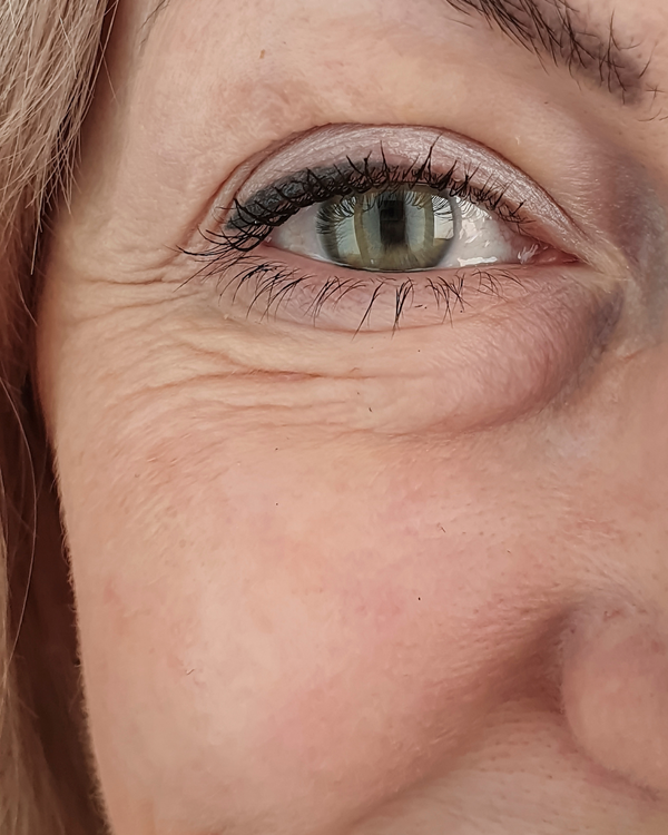 EARLY AGEING